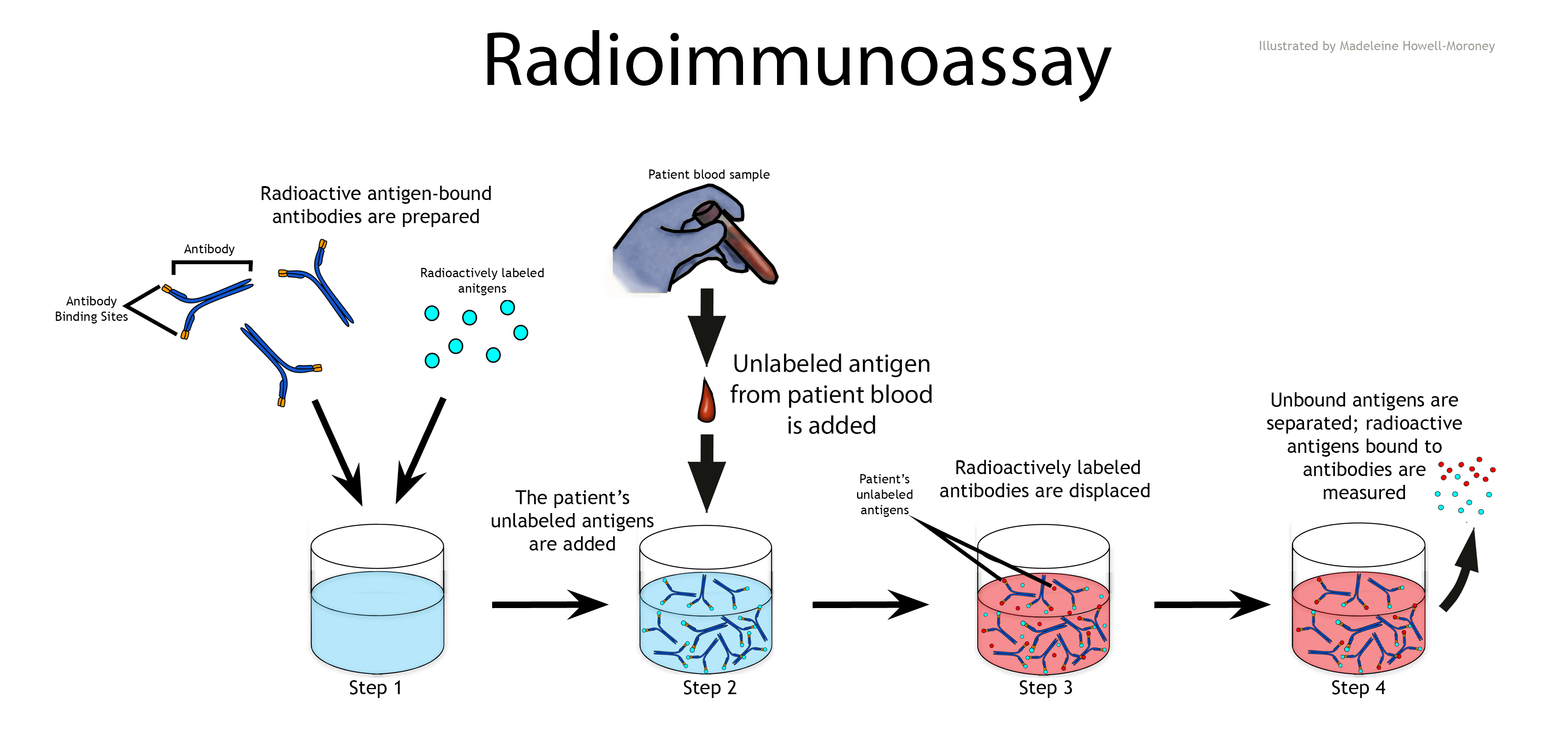 Radioimmunoassay - image