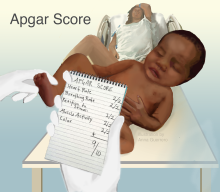 an illustration of a baby and a nurse's hand holding an Apgar score